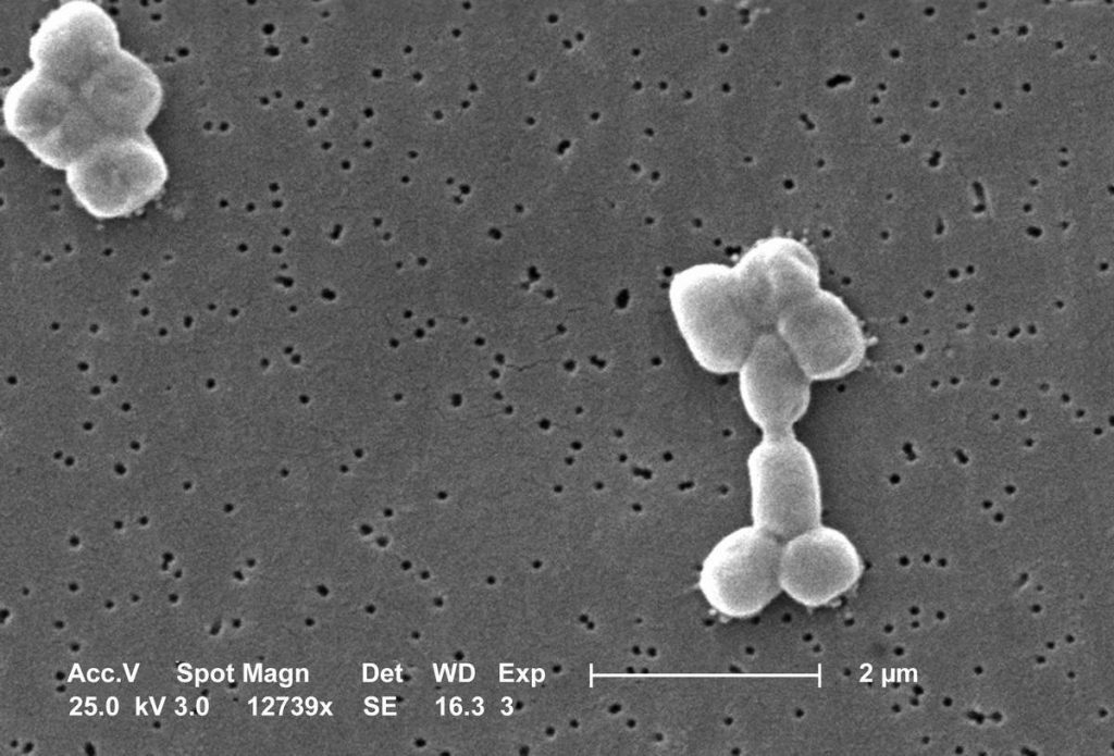 Acinetobacter baumannii can cause a variety of infections.